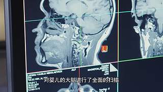 【所长来了】打开宇宙的未知