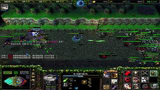 肘管综合症患者