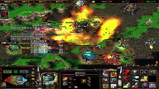 肘管综合症患者