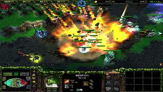 肘管综合症患者