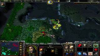 帕金森中年老登