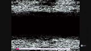 失落的记录：绽放与愤怒