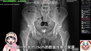 天道酬勤 慢慢加油